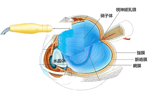 代替画像