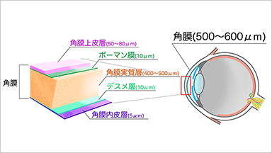 CORNEAL角膜疾患とは