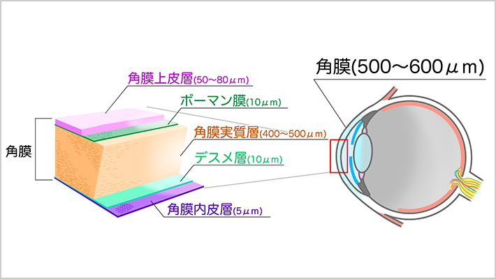 角膜疾患 | 江南市・一宮市の眼科診療なら愛岐中央眼科・愛岐眼科