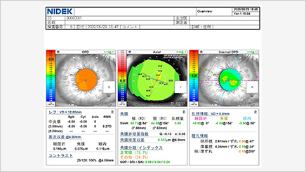【OPD-Scan III】NIDEK社製