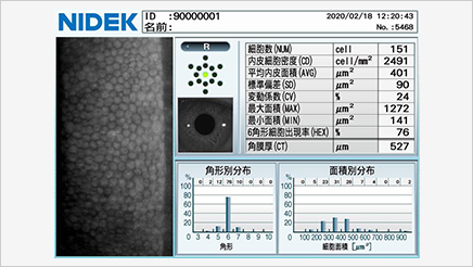 【CEM-530 PARACENTRAL®】NIDEK社製