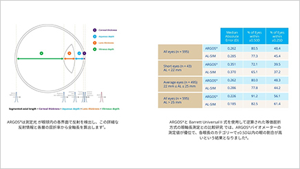 【ARGOS】ALCON社製