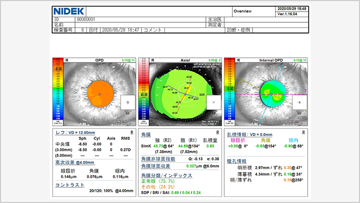 【OPD-Scan III】NIDEK社製