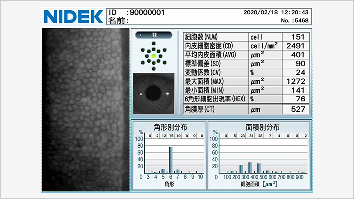 【CEM-530 PARACENTRAL®】NIDEK社製