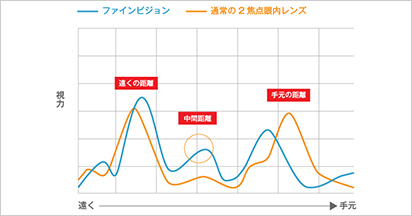 PREMIUM02選定療養非対象（自由診療）のプレミアム眼内レンズ