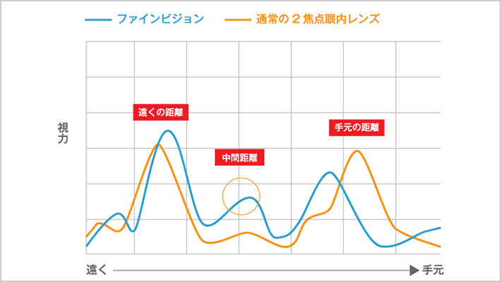 PREMIUM02選定療養非対象（自由診療）のプレミアム眼内レンズ