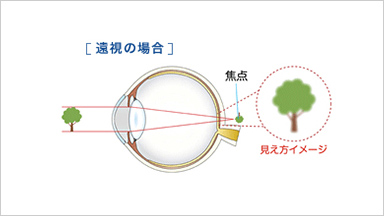 FOCUSピントの仕組み