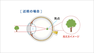 FOCUSピントの仕組み