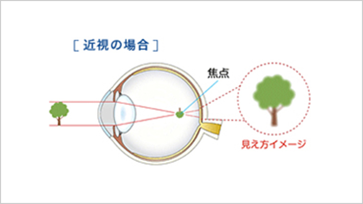 FOCUSピントの仕組み