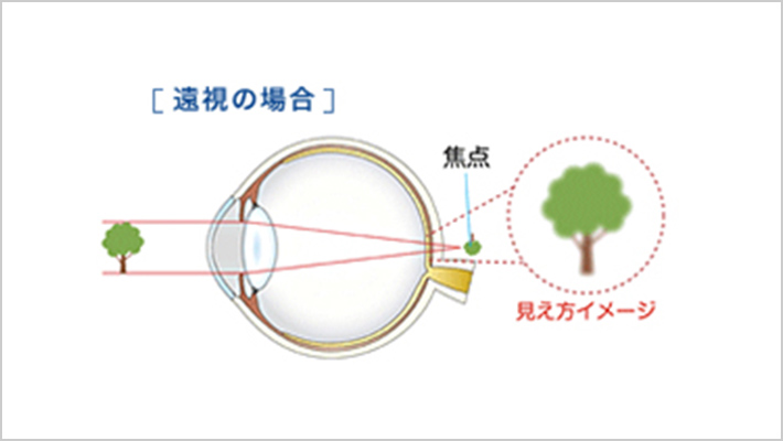 FOCUSピントの仕組み